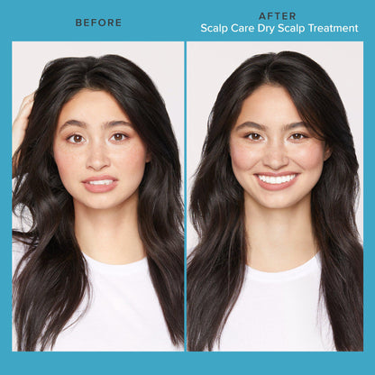 Scalp Care Dry Scalp Treatment - Scentbar